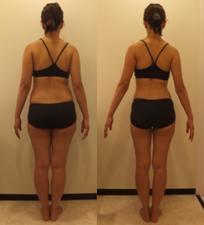 リボーンマイセルフのモニター結果「下半身と太もも脚痩せのビフォーアフター」を紹介Ⅲ！