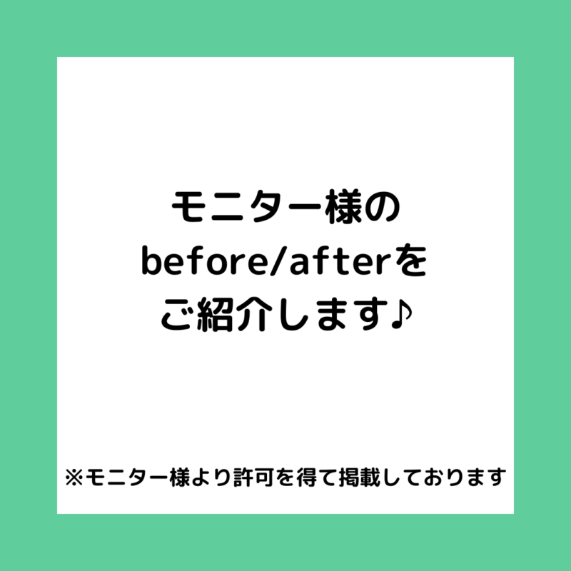 モニター様のbefore/afterをご紹介します♪