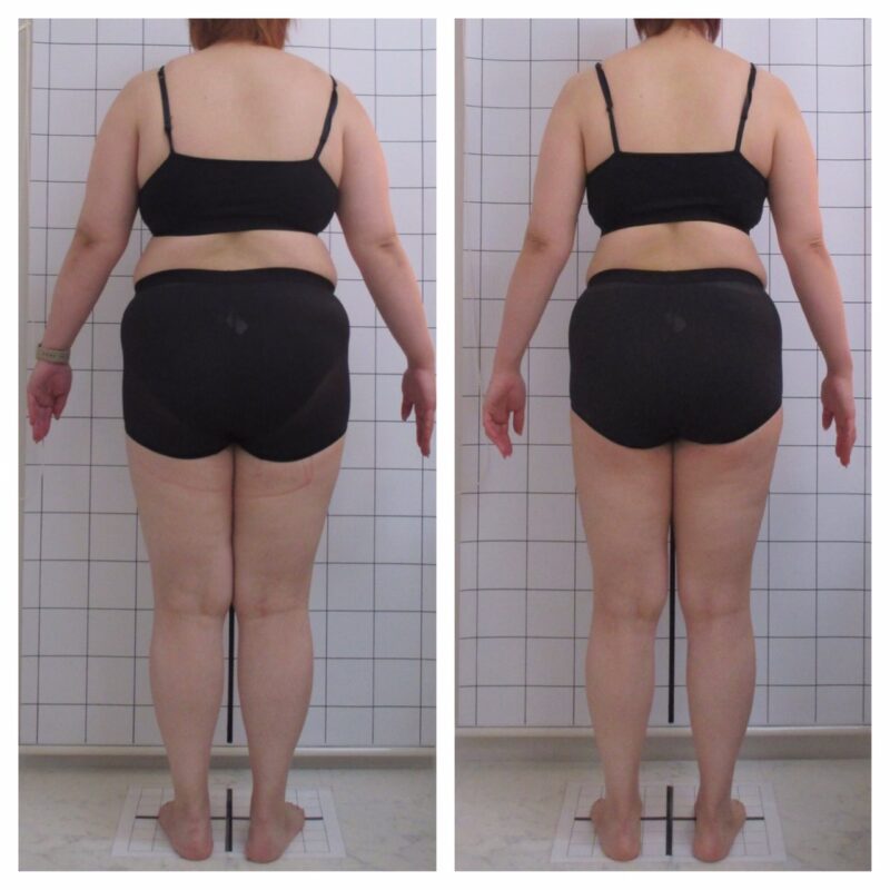 お背中が周りが綺麗になりました！